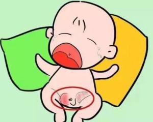 阴囊疝气 - 搜狗百科