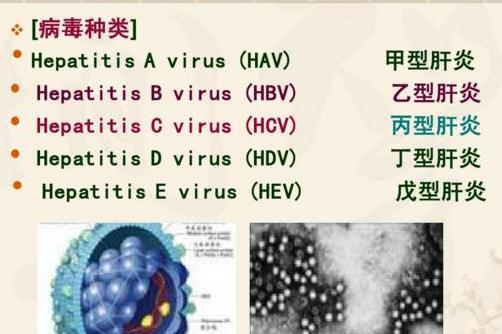 甲型肝炎 由甲型肝炎病毒引起的传染病 搜狗百科