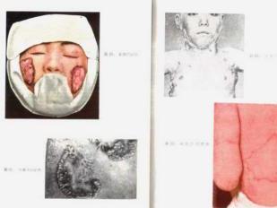 花柳病 搜狗百科