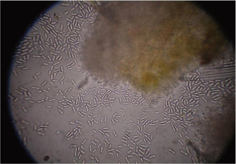 盘长孢状刺盘孢