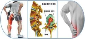 腰椎图片