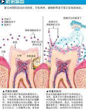 含氟牙膏