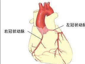 心臟支架手術