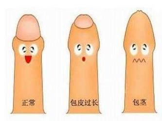 包茎 搜狗百科 包茎 搜狗百科