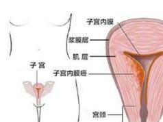 子宫内膜不规则脱落