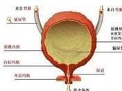 膀胱刺激征