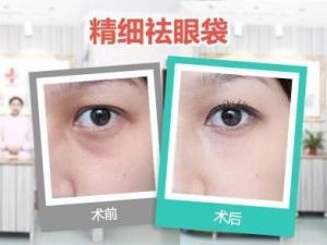 祛眼袋