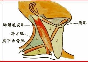 胸骨舌骨肌综合征图片