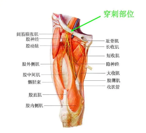 下肢动脉位置图片图片