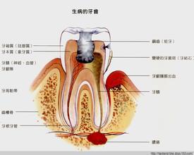 空洞上部宽阔,称为牙髓腔,下部有管状的根管,由之