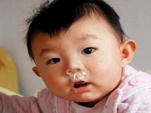 流黄鼻涕