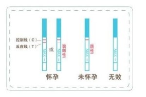 检查方法