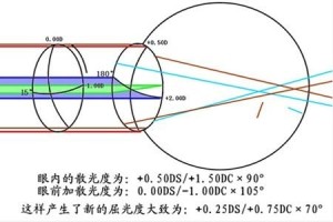 散光轴位图图片