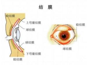 结膜