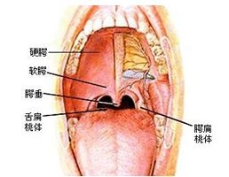 扁桃体肿大