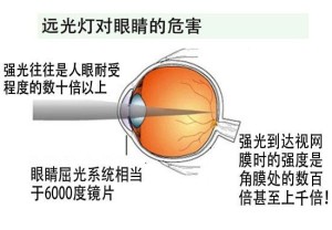 太阳镜