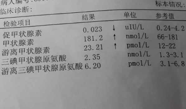 甲功五项化验单图片