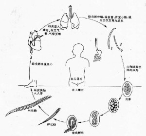 钩虫皮炎图片