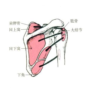 大圆肌疼痛怎么缓解图片