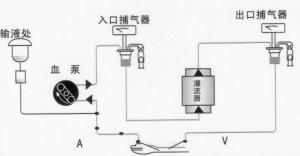 单独血液灌流