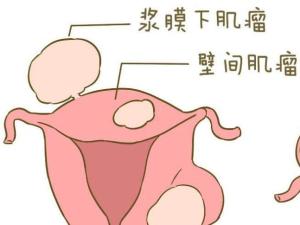 妇科病