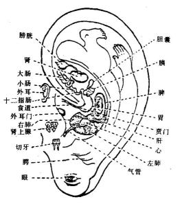 耳朵人体全息示意图