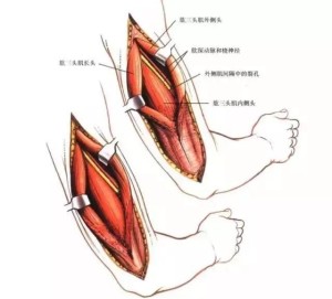 肱三头肌
