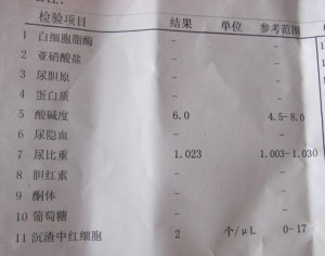 尿蛋白弱阳性