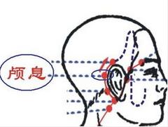 颅息