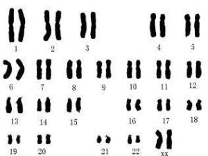 染色体核型分析