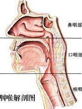 急性喉气管支气管炎