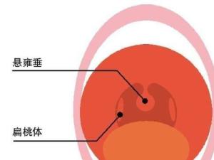 悬雍垂正常图片图片