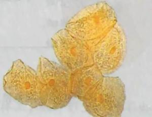 人口腔上皮细胞