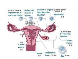 子宫腺肌症