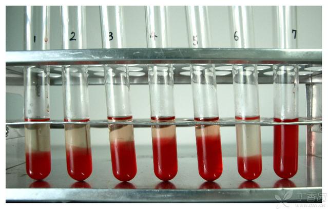 溶血样本图片