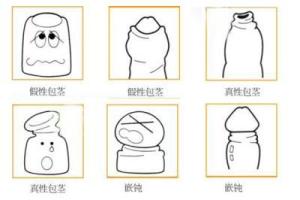 嵌顿包茎 搜狗百科 嵌顿包茎 搜狗百科