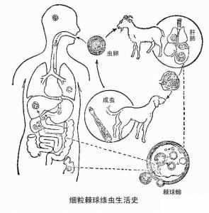 细粒棘球蚴病图片图片