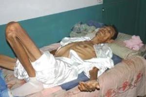 垂死挣扎的病人