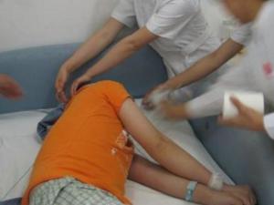 重症肌无力