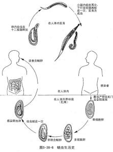 蛲虫