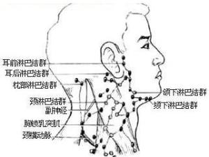 淋巴结肿大