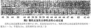 慢性自律性房性心动过速