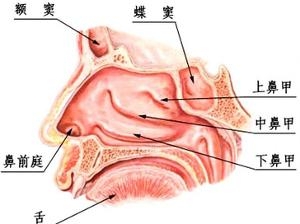 蝶窦炎