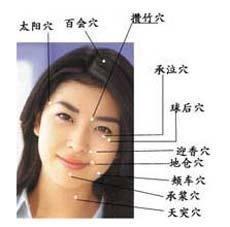针灸减肥