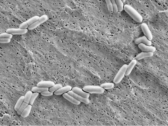 hansen bb-12被鉴定为动物双歧杆菌乳双歧亚种.chr.