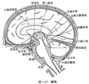 大脑前纵裂池图片