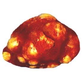 结核病状 结核病状