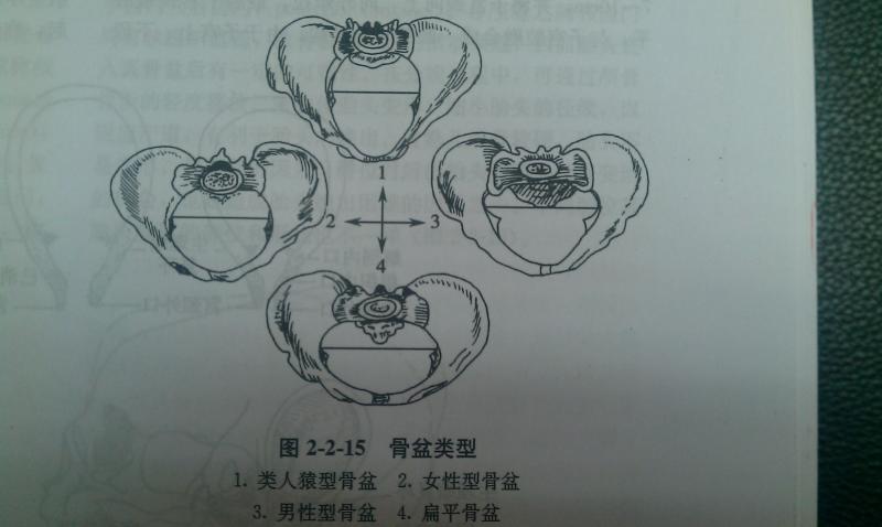 骨产道测量及图解图片