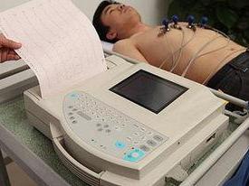 心电图检查