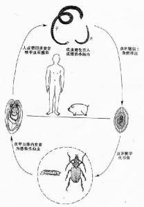 猪巨吻棘头虫卵手绘图图片